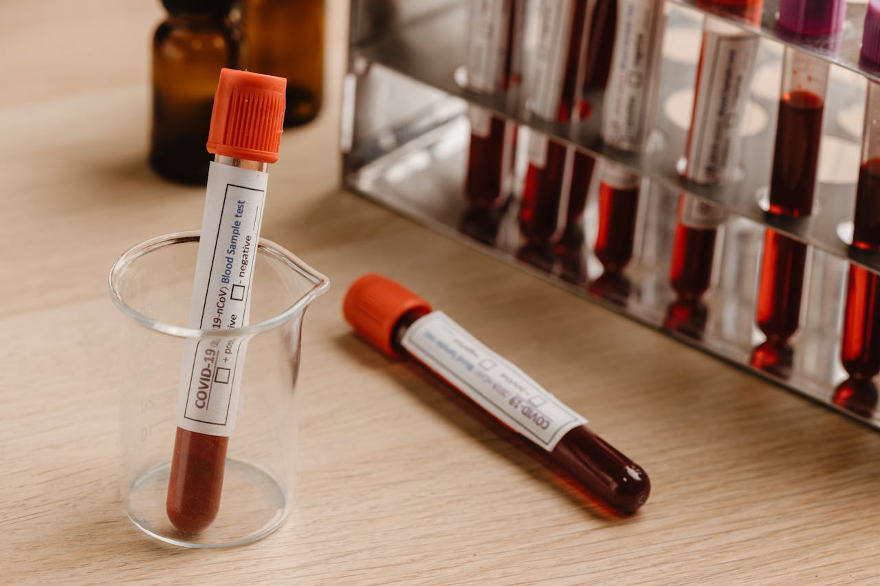Importance of Blood Collection Tubes in Laboratory Testing